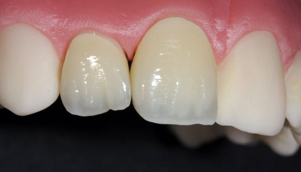 23kurs_frontseite_keramik